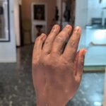 Nigerian innovator Ubokobong Amanam displays a functional bionic prosthetic arm developed to combine realistic appearance with movement.