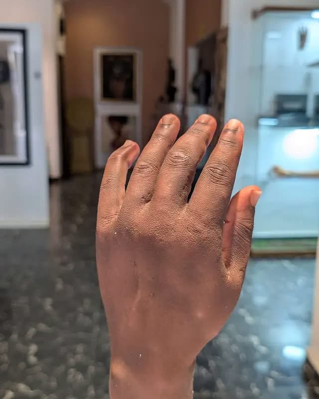 Nigerian innovator Ubokobong Amanam displays a functional bionic prosthetic arm developed to combine realistic appearance with movement.