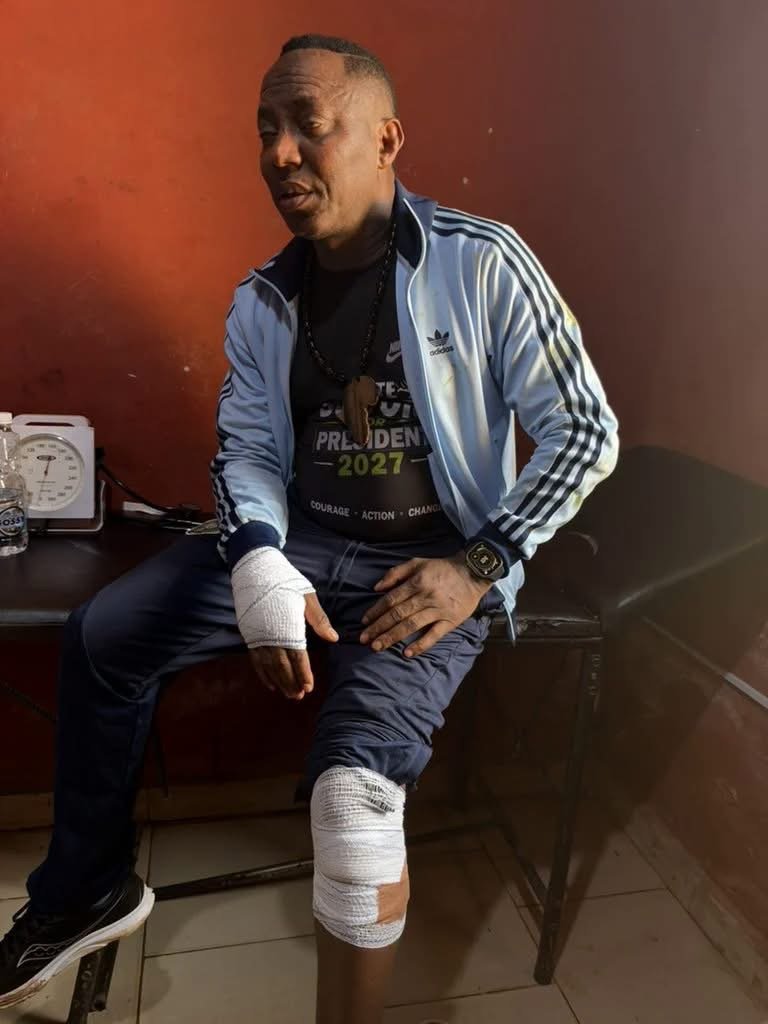 Omoyele Sowore, African Action Congress presidential candidate, after a reported confrontation in Ado-Ekiti, Ekiti State, on October 30, 2026.